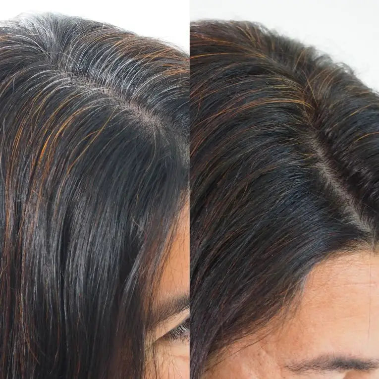 Tratamiento Para Canas Nexo + Tonico Capilar (Gratis)